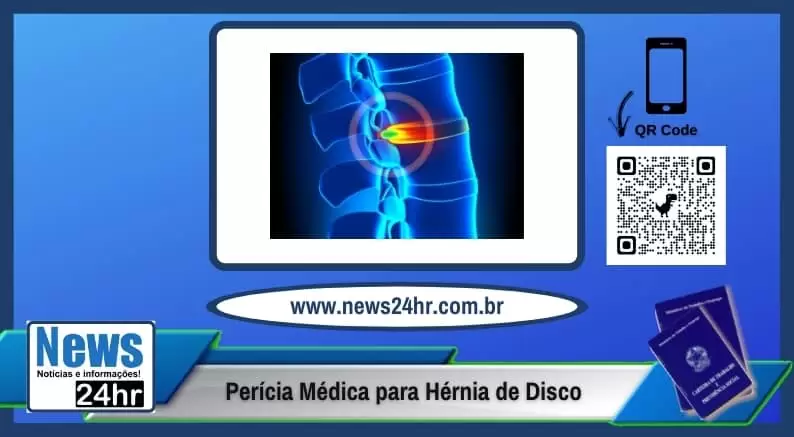 Perícia Médica para Hérnia de Disco